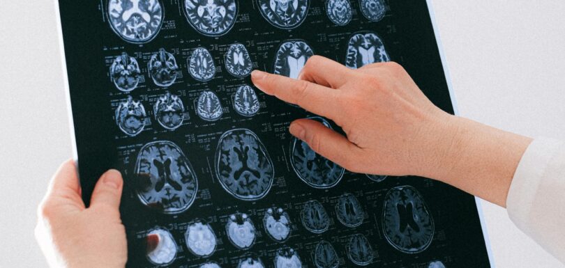 Advanced technology for Depression Treatment Options Miami at our innovative psychiatry Florida center.