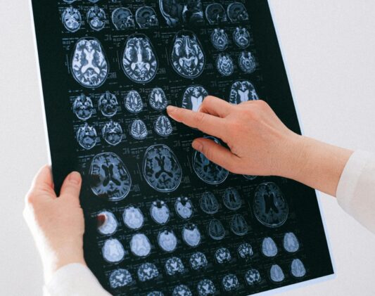 Advanced technology for Depression Treatment Options Miami at our innovative psychiatry Florida center.